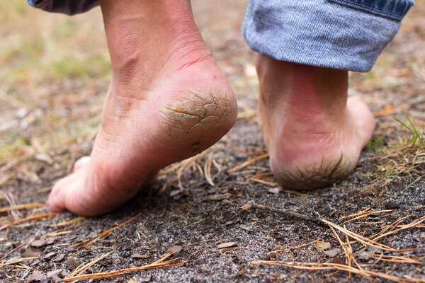 穿高跟鞋易腰痛性冷淡　如何正確穿高跟鞋
